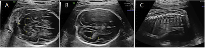 FIGURE 4