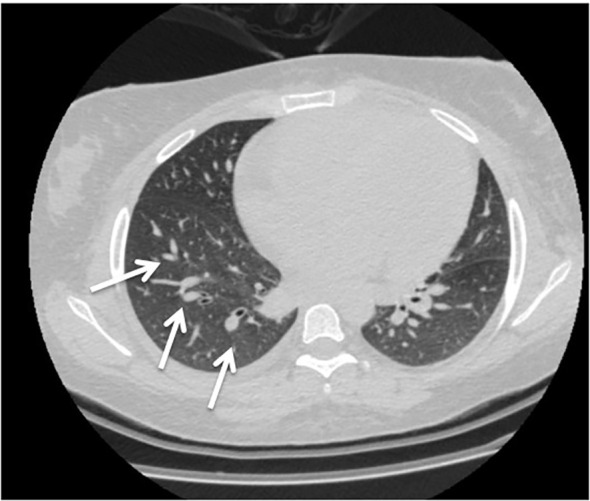 Figure 1