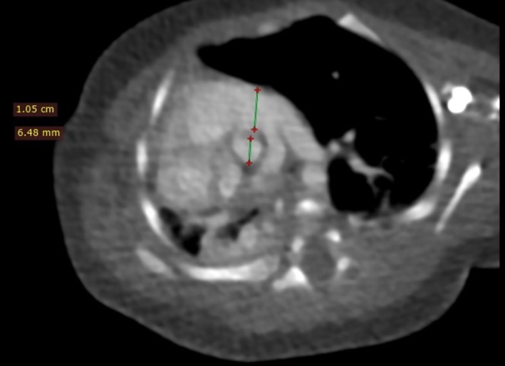 FIGURE 3