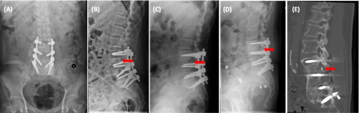 FIGURE 1