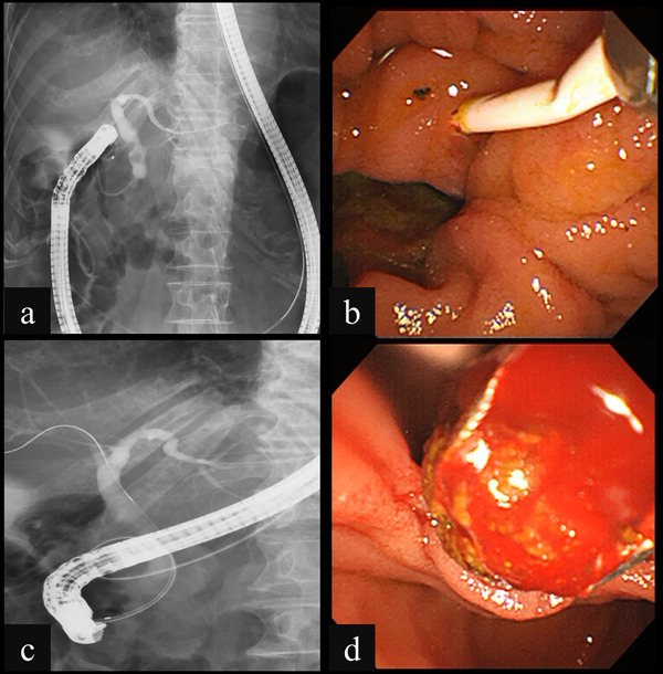 FIGURE 3