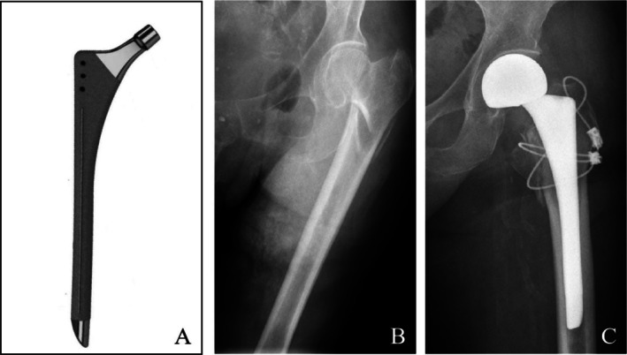 FIGURE 4