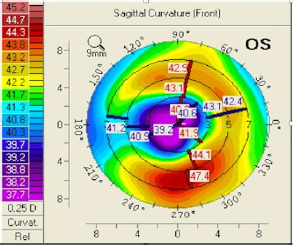 Figure 9