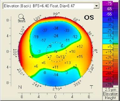 Figure 11