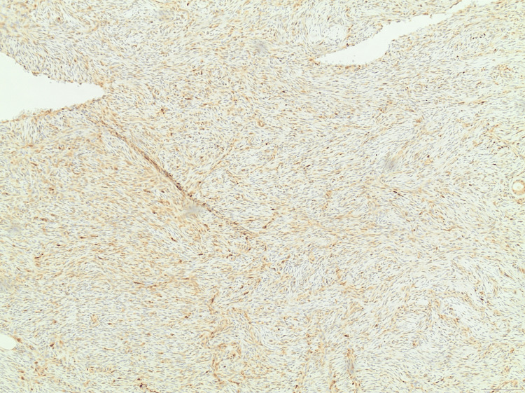 Figure 9