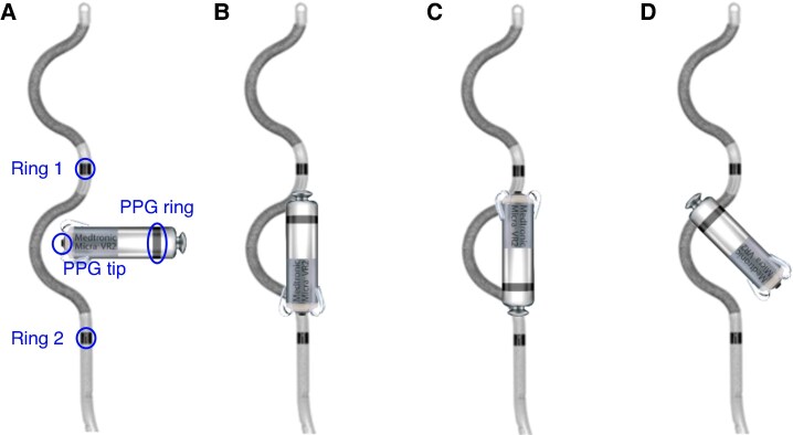 Figure 13