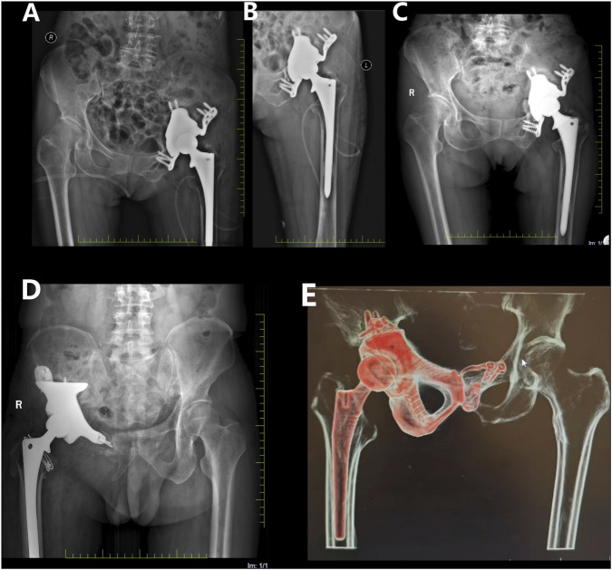 Figure 9