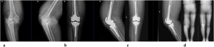 FIGURE 13