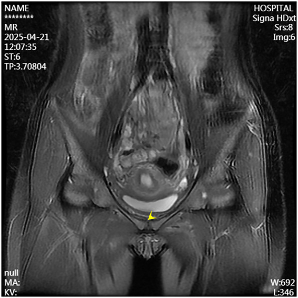 Figure 6