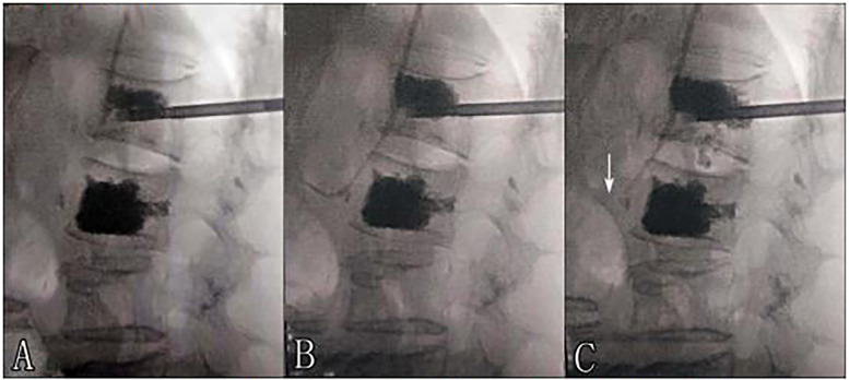 Figure 1