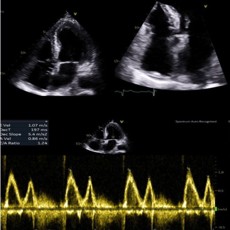 Figure 6