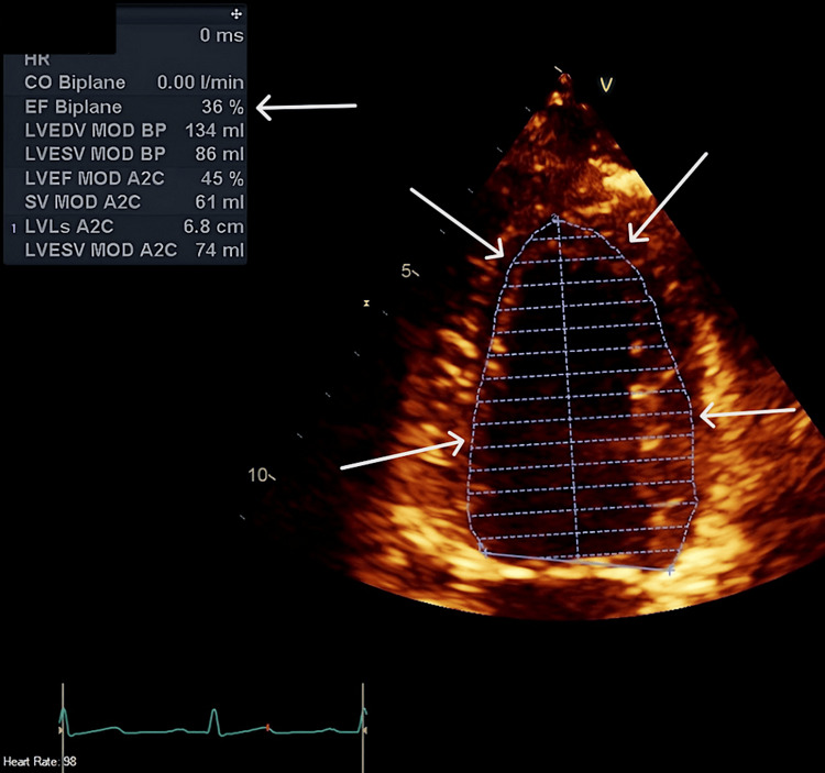 Figure 4