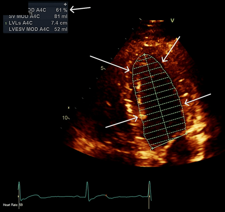 Figure 6
