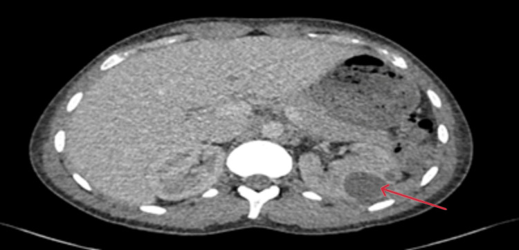 Figure 9
