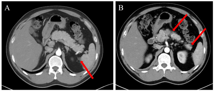 Figure 2