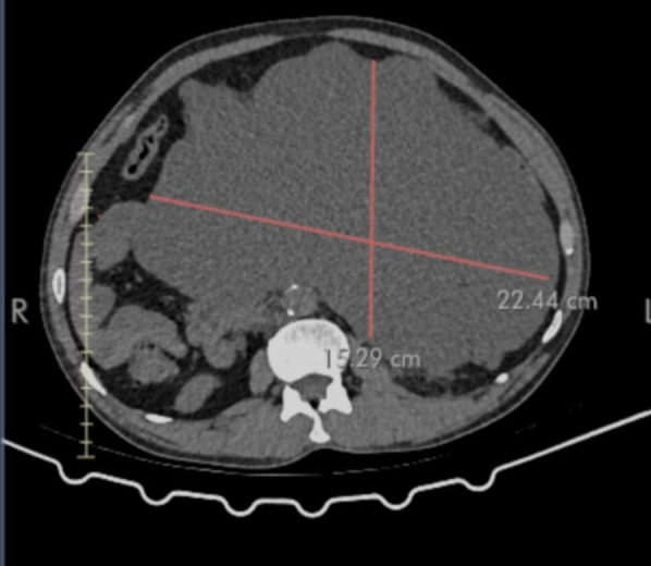 Fig 2