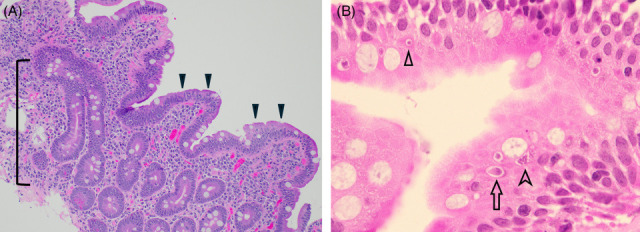 FIG 1