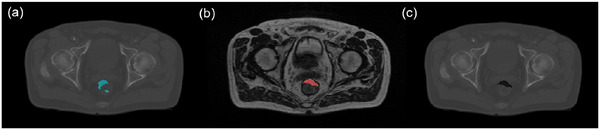 Figure 16