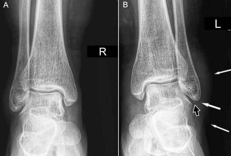 Figure 13