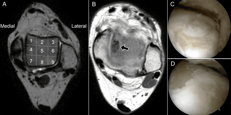 Figure 17