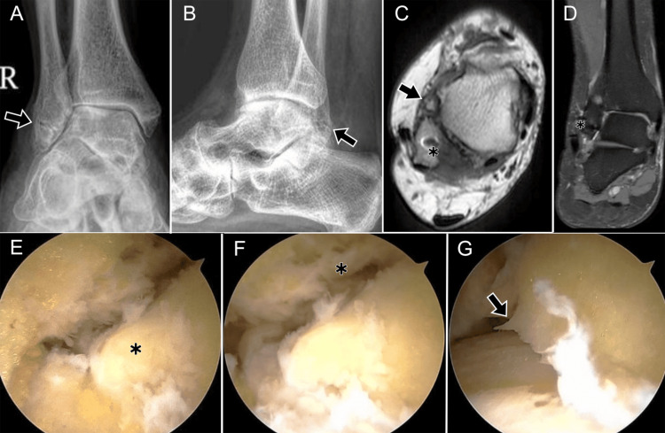 Figure 18