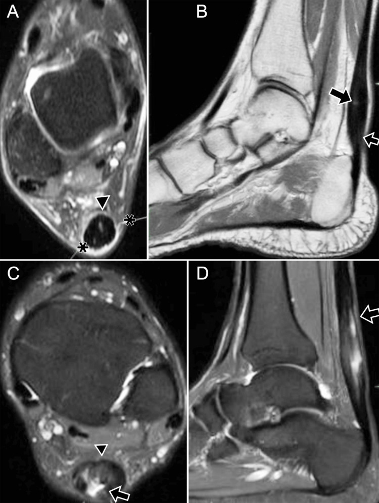 Figure 19