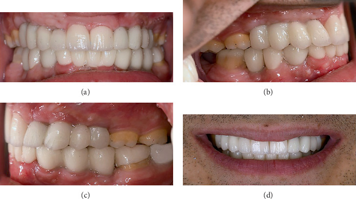 Figure 6
