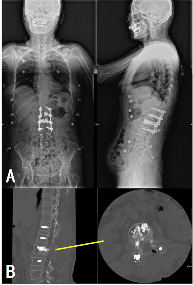 Figure 6