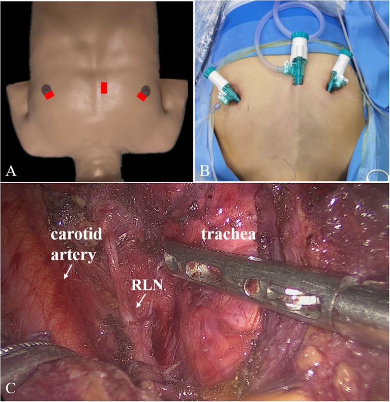 Figure 1