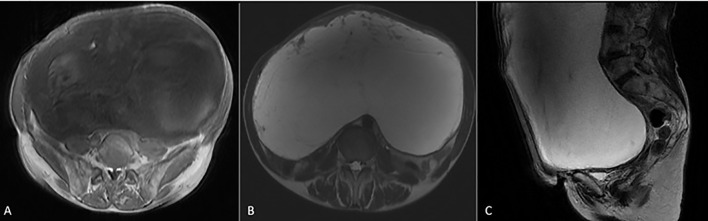Figure 2