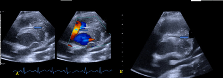 Figure 9