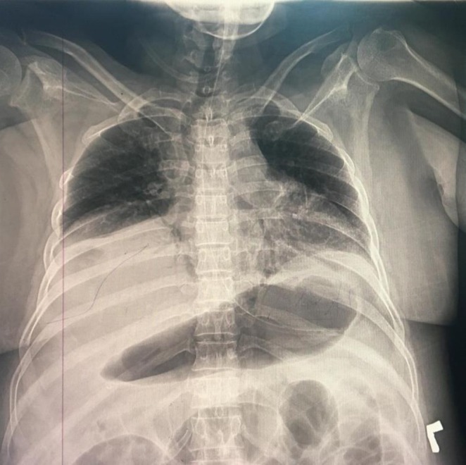 FIGURE 1