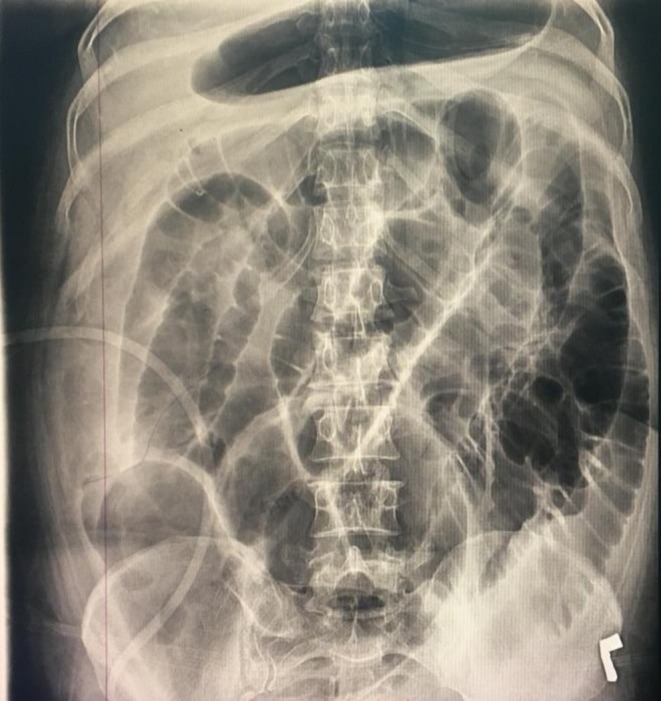 FIGURE 2