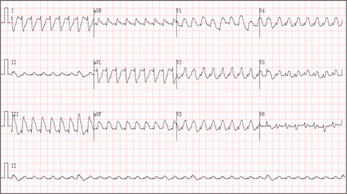 FIGURE 3