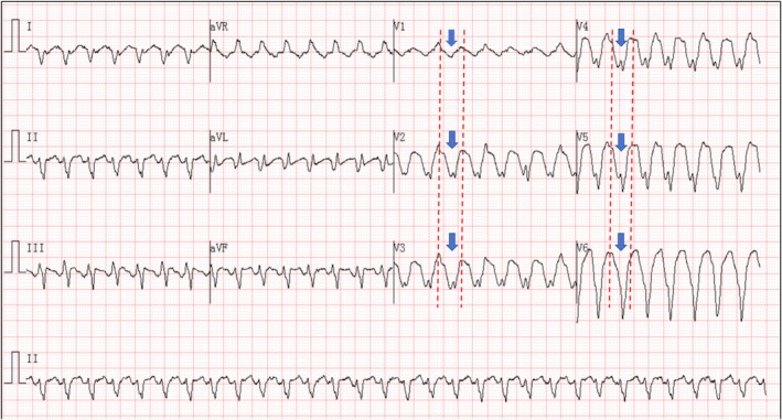 FIGURE 1