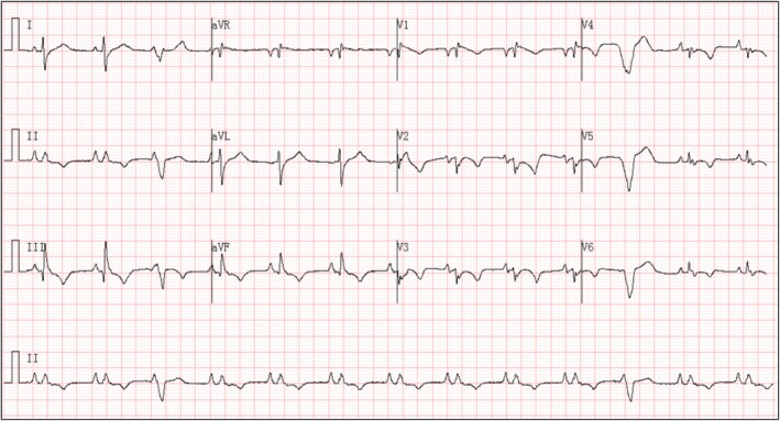 FIGURE 2