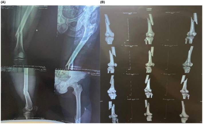 FIGURE 1