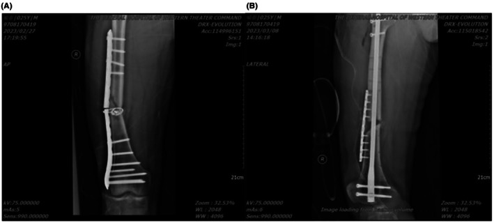 FIGURE 2