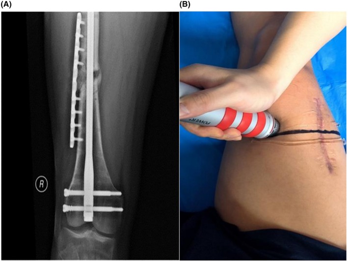 FIGURE 3