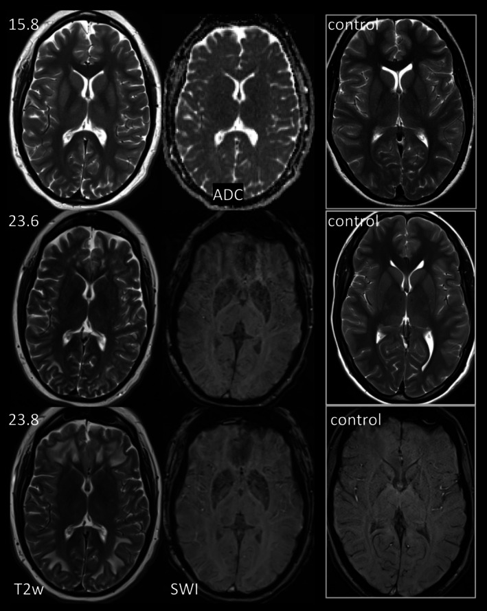 FIGURE 2