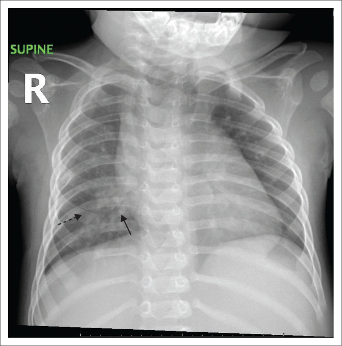 FIGURE 3