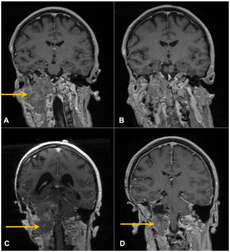 Figure 2