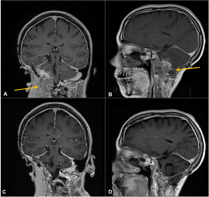 Figure 4