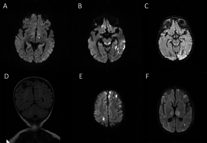 FIGURE 1