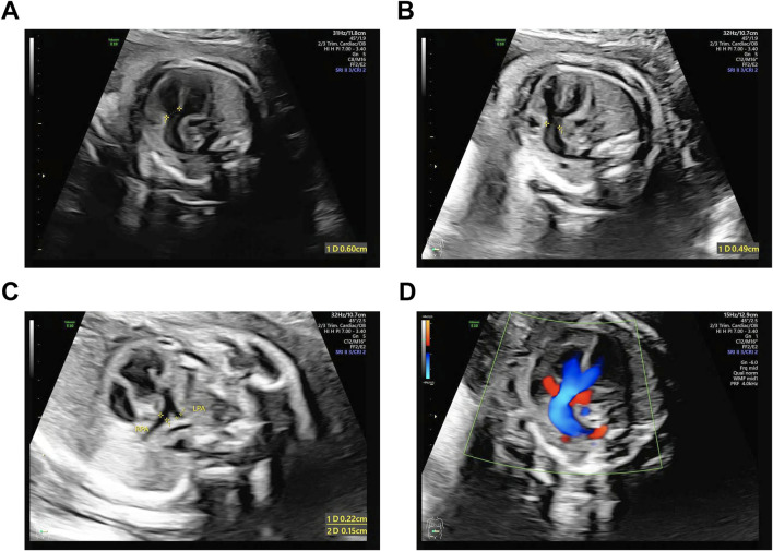 FIGURE 1