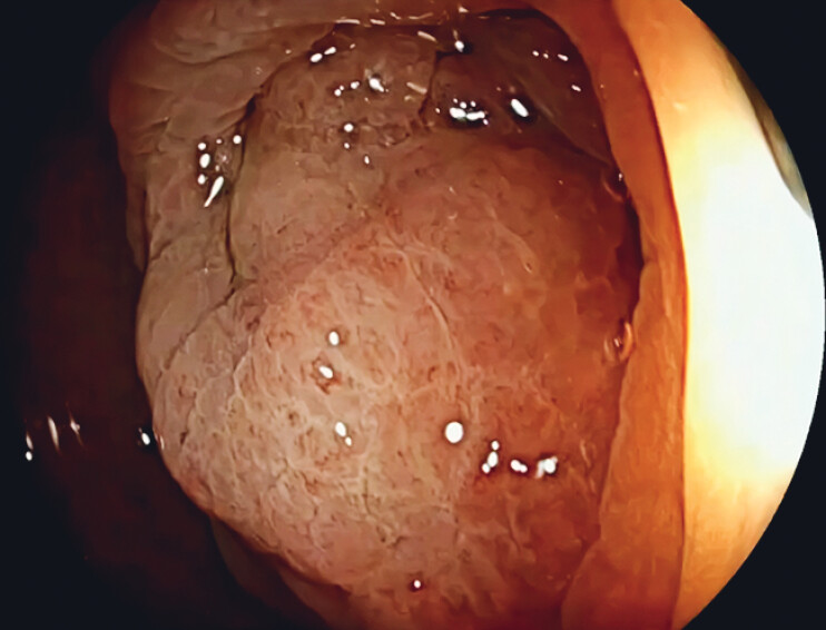 Fig. 2