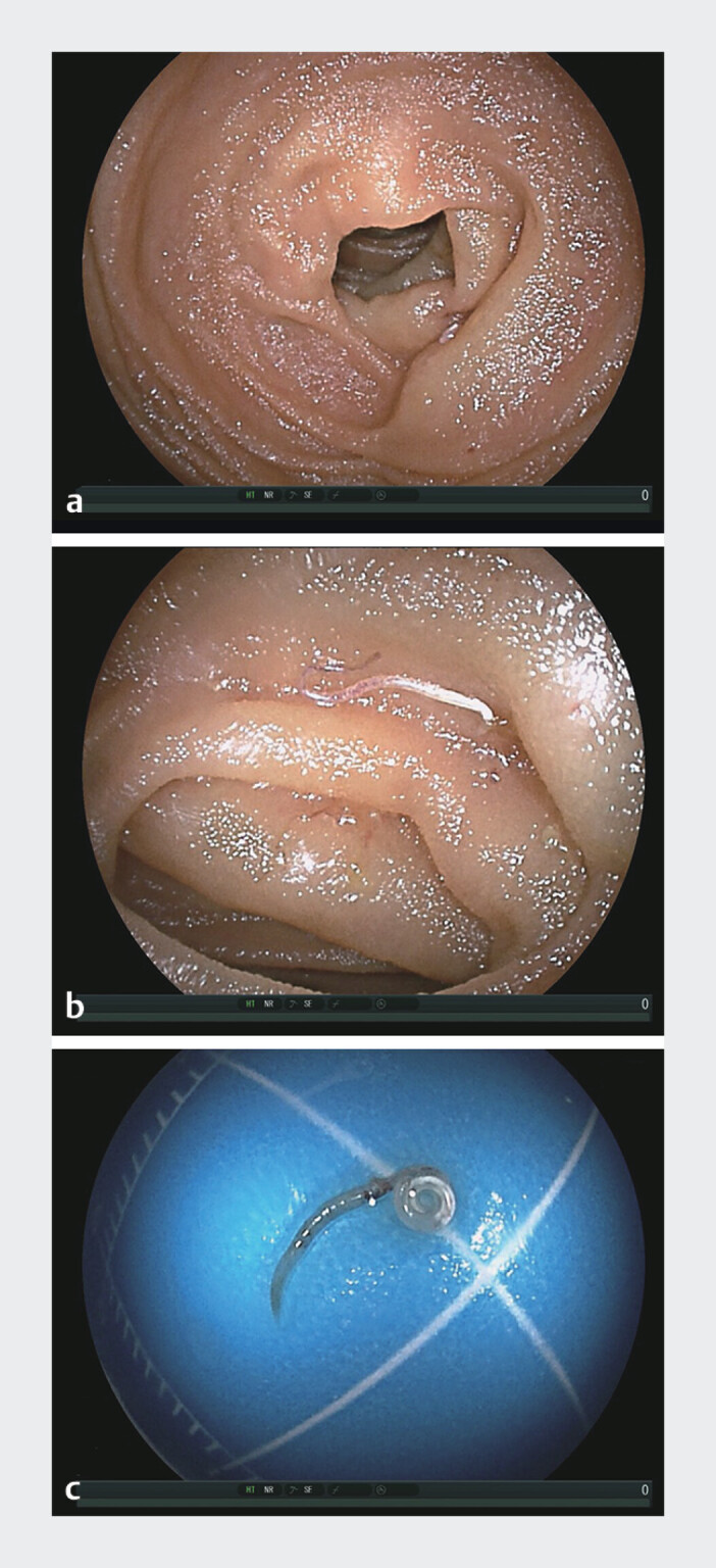 Fig. 2
