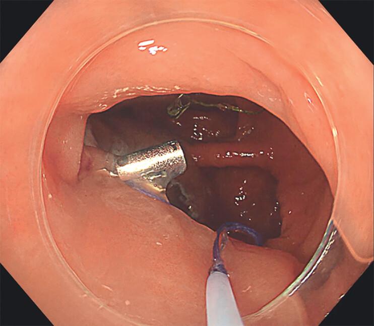 Fig. 3