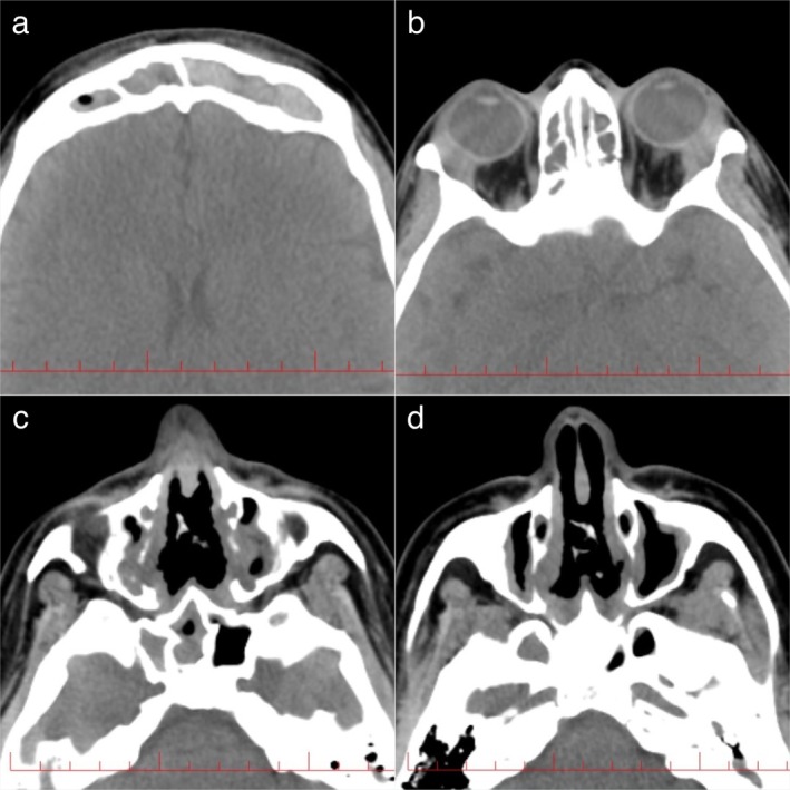 FIGURE 4