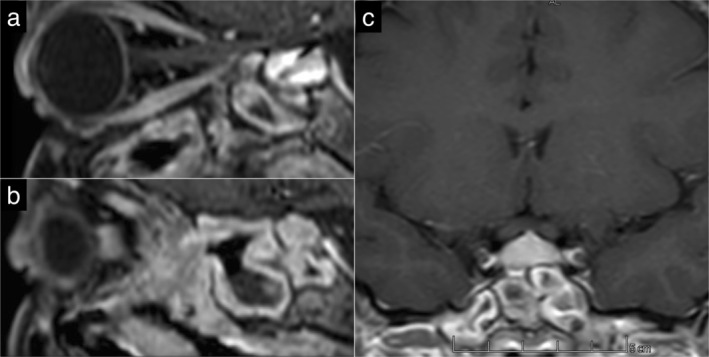 FIGURE 2